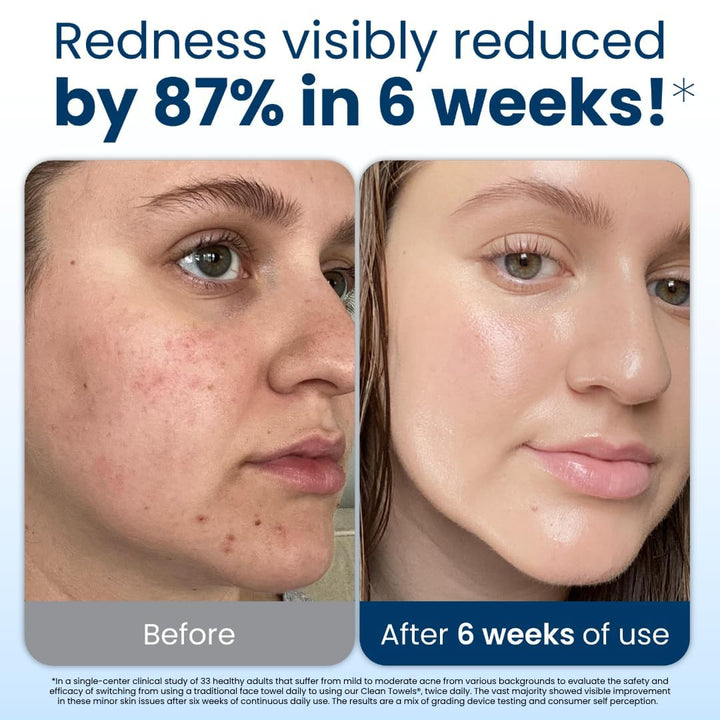 Face Towel Disposable