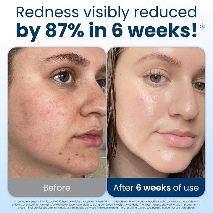 Face Towel Disposable