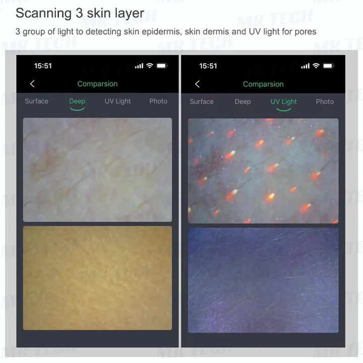 Smart WiFi Skin Analyzer