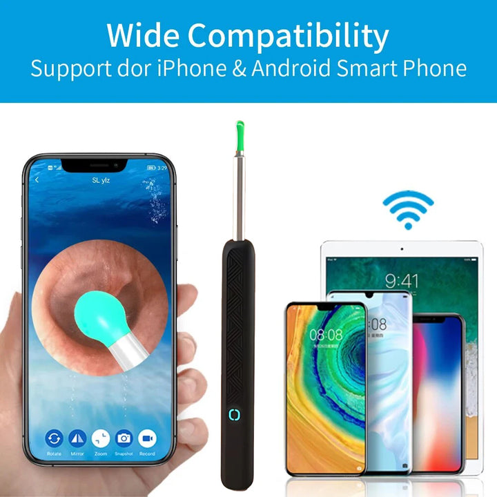 Wireless WiFi Otoscope Camera