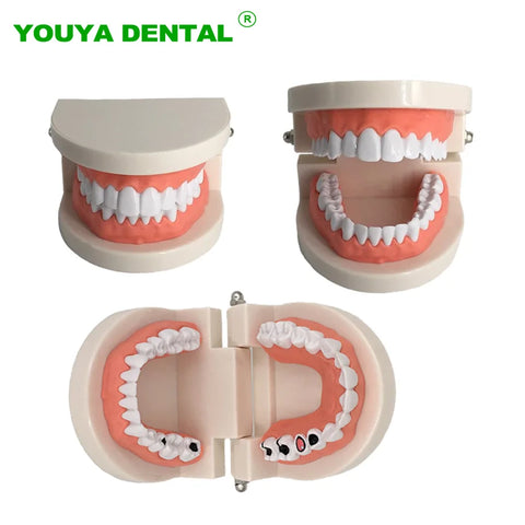 Dental Model Brushing Teeth Education Model