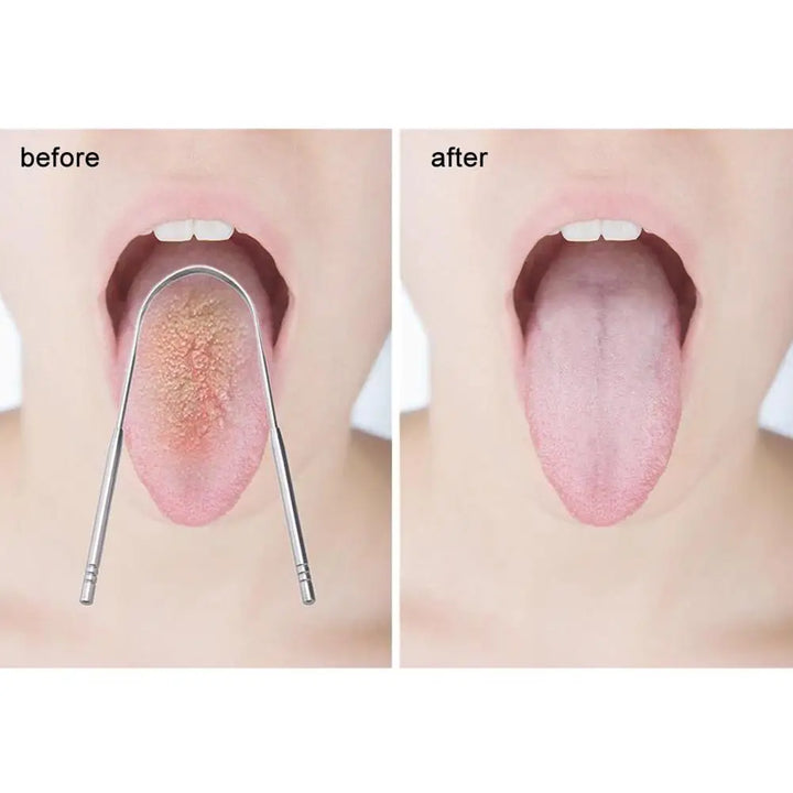 Tongue Scraper Cleaner Fresh Breath Cleaning Coated Tongue Tools Care Toothbrush Quality Hygiene High Quality