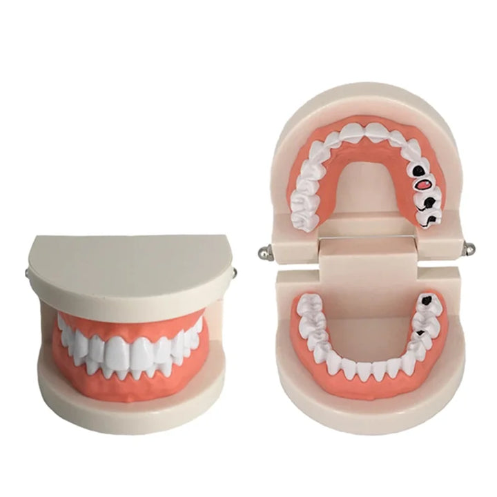 Dental Model Brushing Teeth Education Model